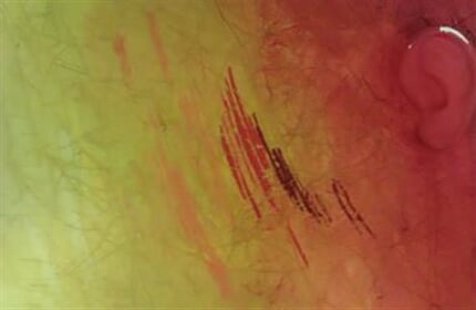 Homage Vincent