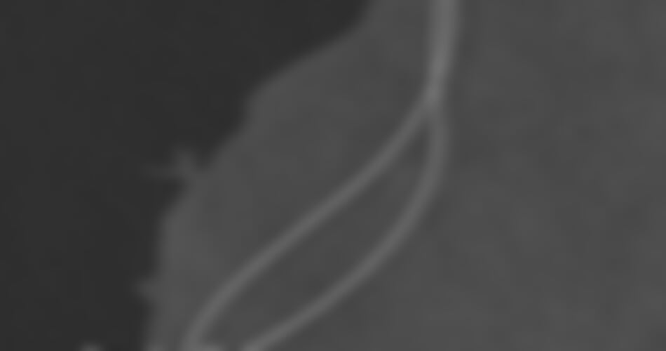 Costa Favolosa - Brazílie (Santos)